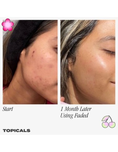Faded Serum for Dark Spots & Discoloration