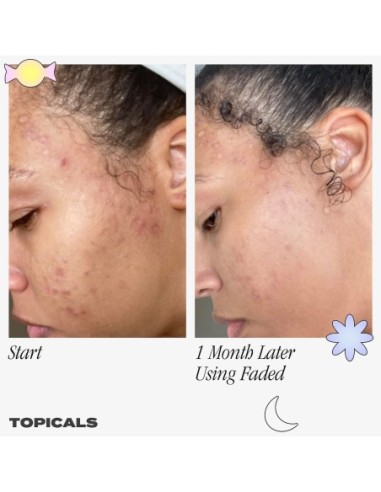 Faded Serum for Dark Spots & Discoloration
