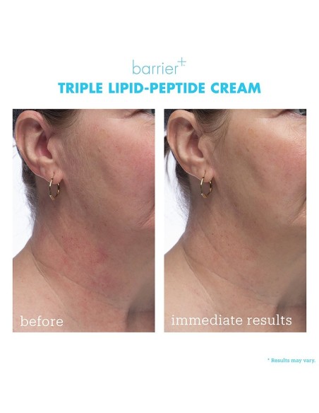 Barrier+ Triple Lipid-Peptide Cream Barrier+ Triple Lipid-Peptide Cream
