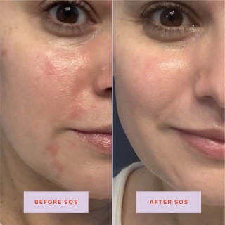 *SOBRE PEDIDO* SOS Daily Rescue Facial Spray 2