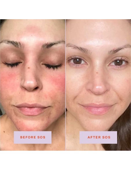 *SOBRE PEDIDO* SOS Daily Rescue Facial Spray *SOBRE PEDIDO* SOS Daily Rescue Facial Spray