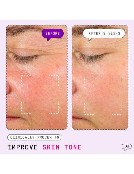 *SOBRE PEDIDO* Major Fade Hyper Serum Dark Spot Treatment *SOBRE PEDIDO* Major Fade Hyper Serum Dark Spot Treatment