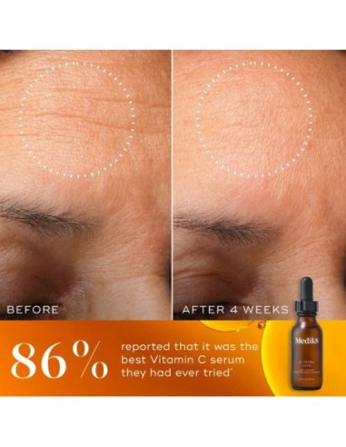 *SOBRE PEDIDO* C-Tetra Luxe