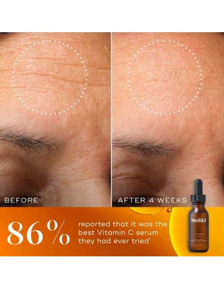 *SOBRE PEDIDO* C-Tetra Luxe *SOBRE PEDIDO* C-Tetra Luxe