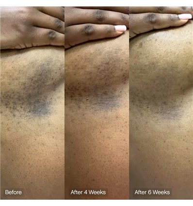 *SOBRE PEDIDO* Faded Brightening & Cleansing Body Bar (2 Pack)