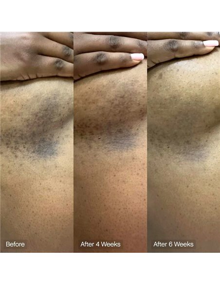 *SOBRE PEDIDO* Faded Brightening & Cleansing Body Bar (2 Pack) *SOBRE PEDIDO* Faded Brightening & Cleansing Body Bar (2 Pack)