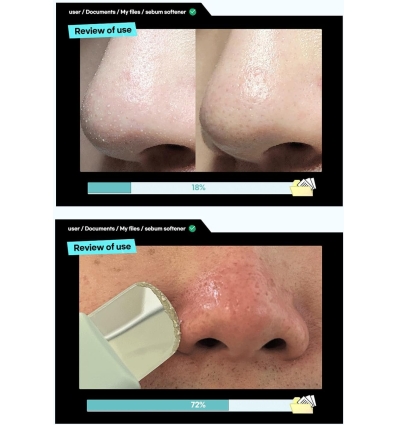 Ilso - Super Melting Sebum Softener
