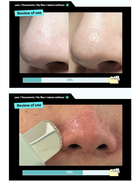 Ilso - Super Melting Sebum Softener Ilso - Super Melting Sebum Softener