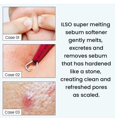 Ilso - Super Melting Sebum Softener