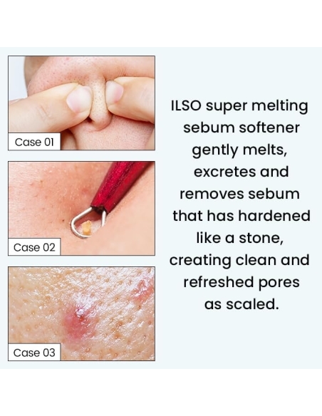 Ilso - Super Melting Sebum Softener Ilso - Super Melting Sebum Softener