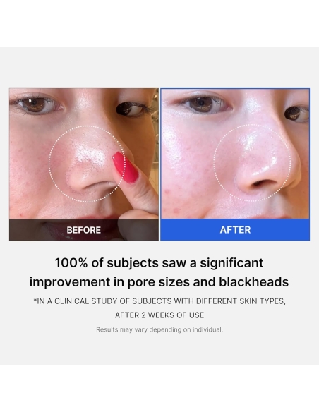 Zero Pore Pad Zero Pore Pad