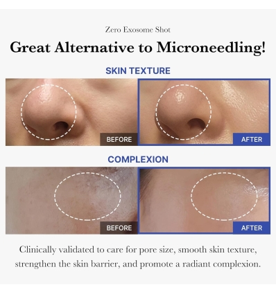 Medicube - One Day Exosome Shot 7500