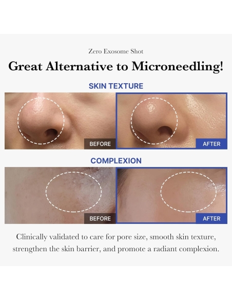 Medicube - One Day Exosome Shot 7500