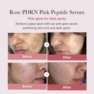 PDRN Pink Peptide Serum 2