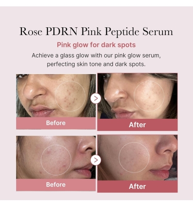 PDRN Pink Peptide Serum