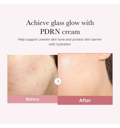 Medicube - PDRN Pink Hyaluronic Moisturizing Cream