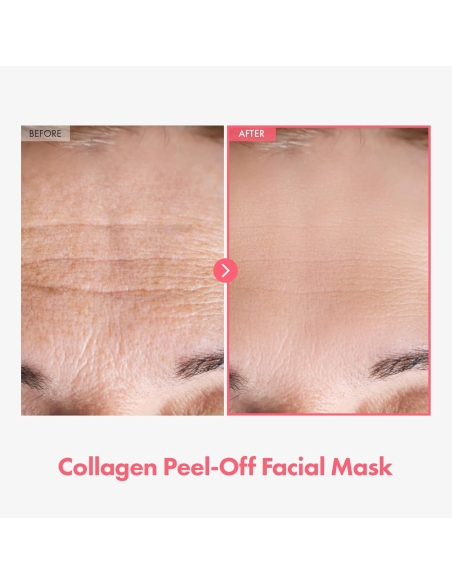 Tosowoong - Real Collagen Fit Tosowoong - Real Collagen Fit