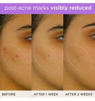 *SOBRE PEDIDO* Brightening & Firming Vitamin-C Serum