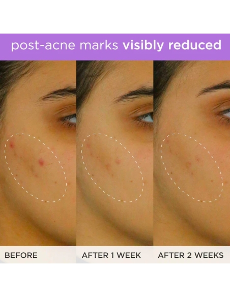 *SOBRE PEDIDO* Brightening & Firming Vitamin-C Serum *SOBRE PEDIDO* Brightening & Firming Vitamin-C Serum