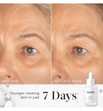 *SOBRE PEDIDO* Liquid Peptides