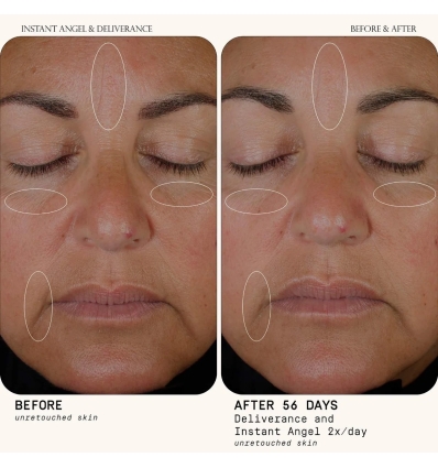 Instant Angel Lipid & Peptide-Rich Moisturizer