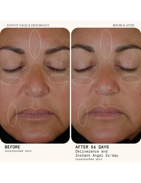 Instant Angel Lipid & Peptide-Rich Moisturizer Instant Angel Lipid & Peptide-Rich Moisturizer