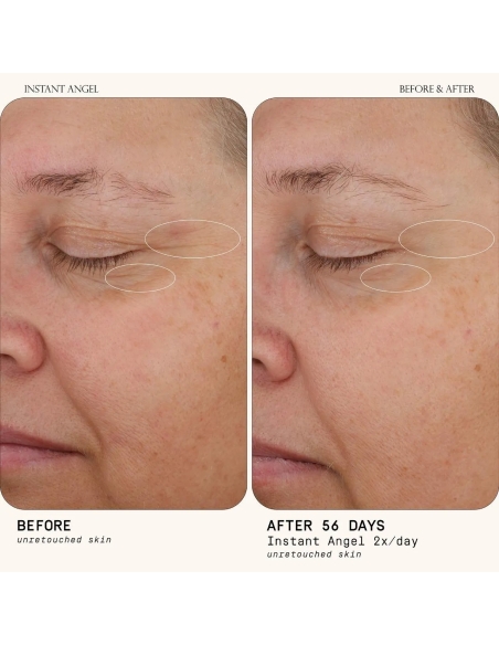 Instant Angel Lipid & Peptide-Rich Moisturizer Instant Angel Lipid & Peptide-Rich Moisturizer