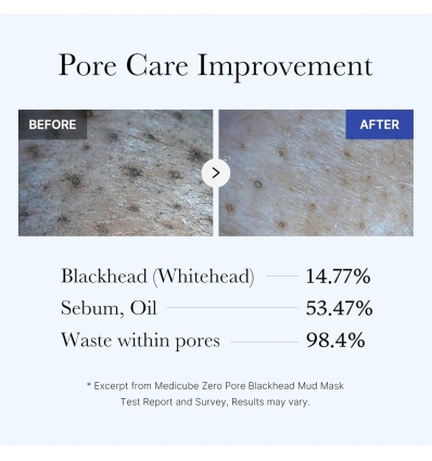 Zero Pore Blackhead Mud Mask