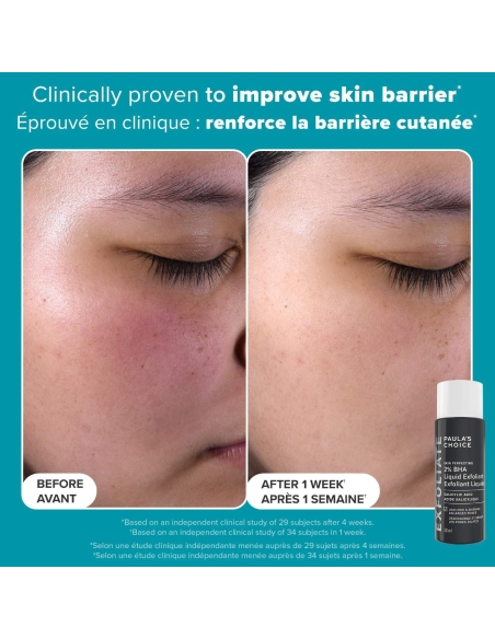 Exfoliation Icons Kit