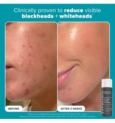 Exfoliation Icons Kit