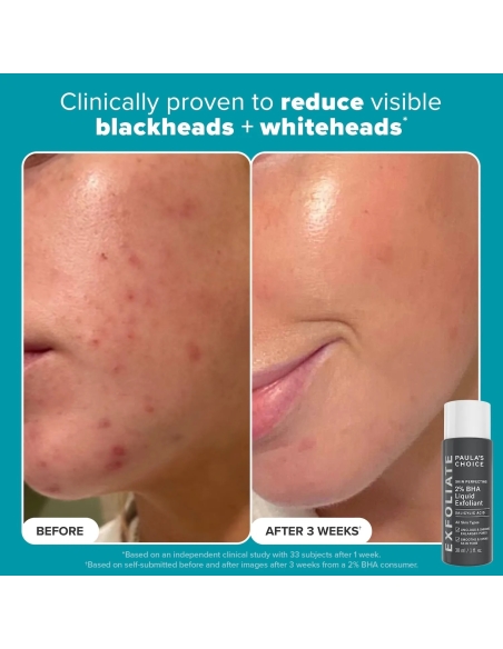 Exfoliation Icons Kit