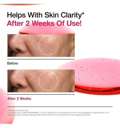 Anua - Niacinamide 10% + TXA 4% Dark Spot Correcting Serum