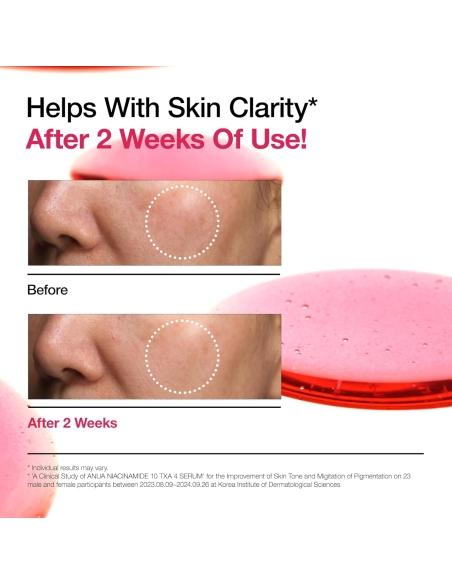 Anua - Niacinamide 10% + TXA 4% Dark Spot Correcting Serum Anua - Niacinamide 10% + TXA 4% Dark Spot Correcting Serum