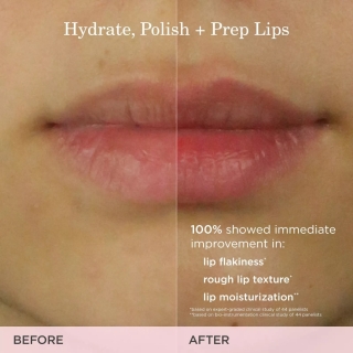 *SOBRE PEDIDO* The Kissu Lip Scrub 2