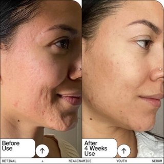 *SOBRE PEDIDO* Retinal + Niacinamide Youth Serum 2