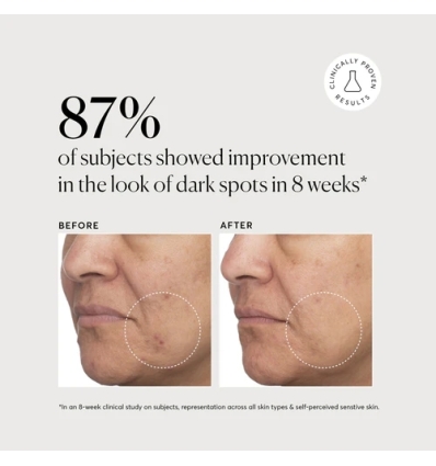 Tranexamic Topical Acid 5%