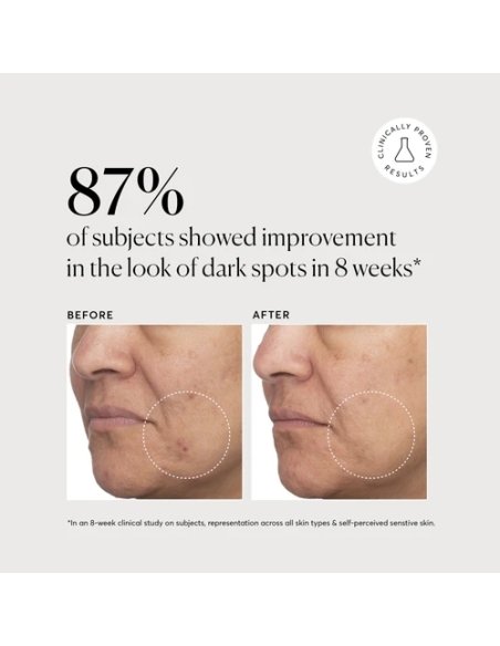 Tranexamic Topical Acid 5% Tranexamic Topical Acid 5%