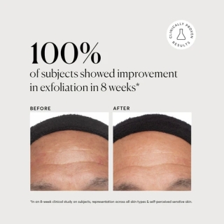 Azelaic Topical Acid 10% 2