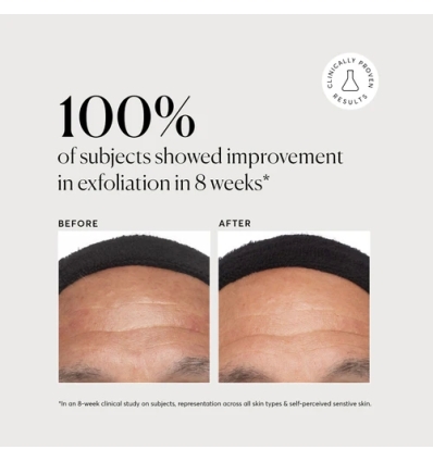 Azelaic Topical Acid 10%