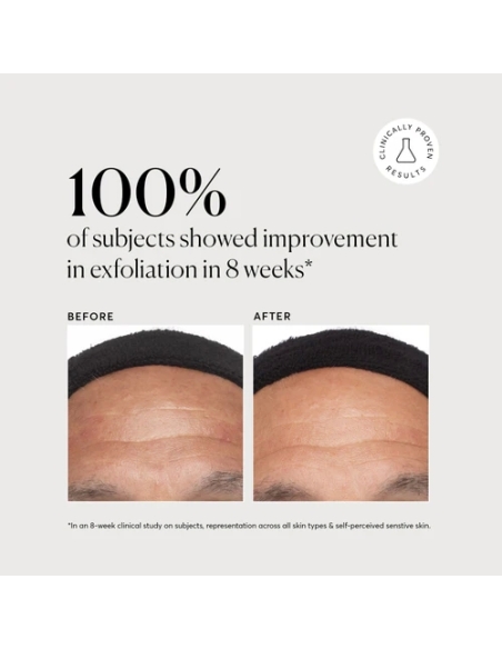 Azelaic Topical Acid 10% Azelaic Topical Acid 10%