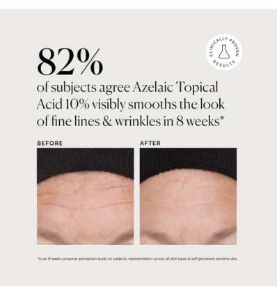 Azelaic Topical Acid 10%