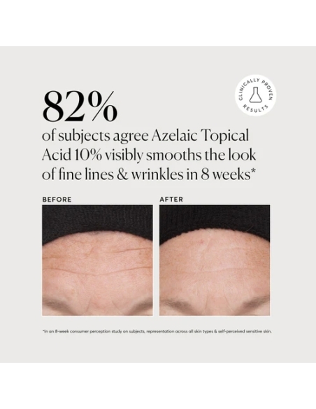Azelaic Topical Acid 10% Azelaic Topical Acid 10%