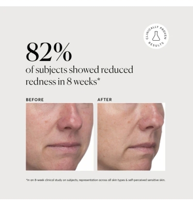 Azelaic Topical Acid 10%