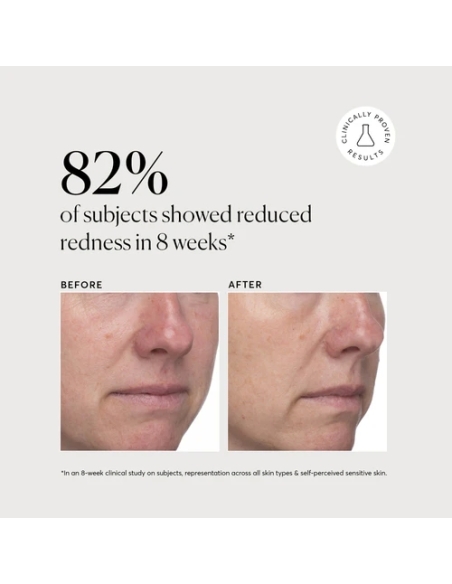 Azelaic Topical Acid 10% Azelaic Topical Acid 10%