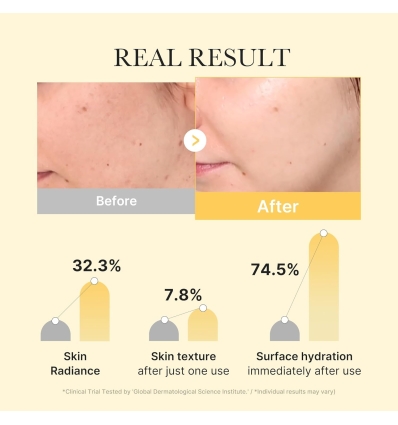 Medicube - Kojic Acid Turmeric Brightening Gel Mask