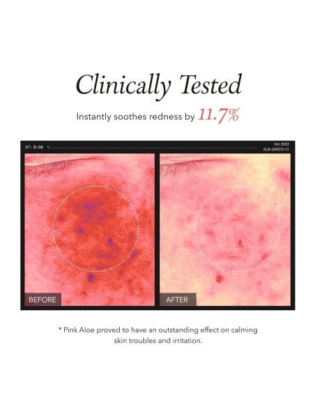 Aprilskin - Pink Aloe Pack Cleanser Aprilskin - Pink Aloe Pack Cleanser