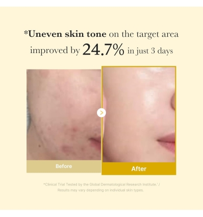 Medicube - Kojic Acid Turmeric Night Wrapping Mask