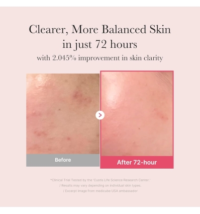 Medicube- TXA+Niacinamide 15% Glow Serum