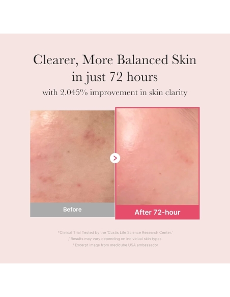 Medicube- TXA+Niacinamide 15% Glow Serum