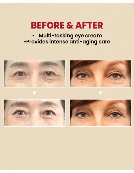 K-Secret - SEOUL 1988 Eye Cream: Retinal Liposome 4% + Fermented Bean K-Secret - SEOUL 1988 Eye Cream: Retinal Liposome 4% + Fermented Bean